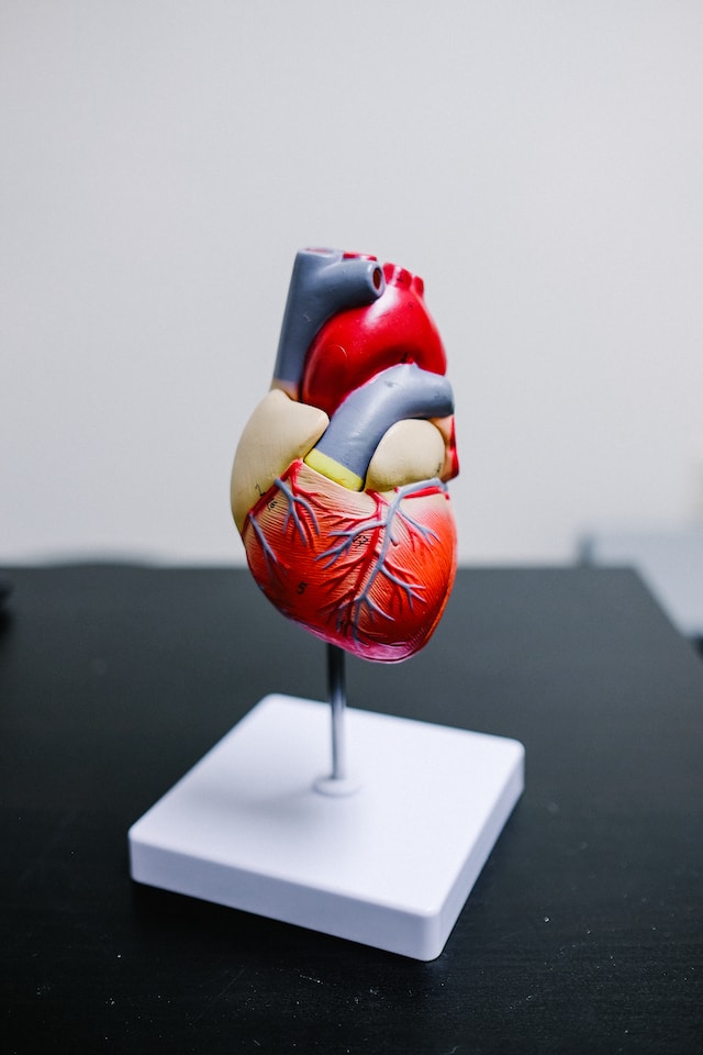cholesterol heart model